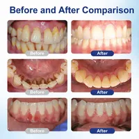 🔥Best Seller-Last Day Sale 60% OFF🔥Oral Repair Solution🔥 thumbnail 6