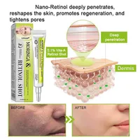 🔥Best Seller-Last Day Sale 60% OFF🔥Celimax Retinal Shot Tightening Booster 15ml thumbnail 6