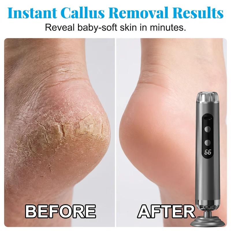 💎 Premium 5-Speed Foot File – Salon Results at Home | 50% OFF Sale 🔥 thumbnail 3