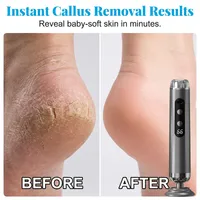 💎 Premium 5-Speed Foot File – Salon Results at Home | 50% OFF Sale 🔥 thumbnail 3