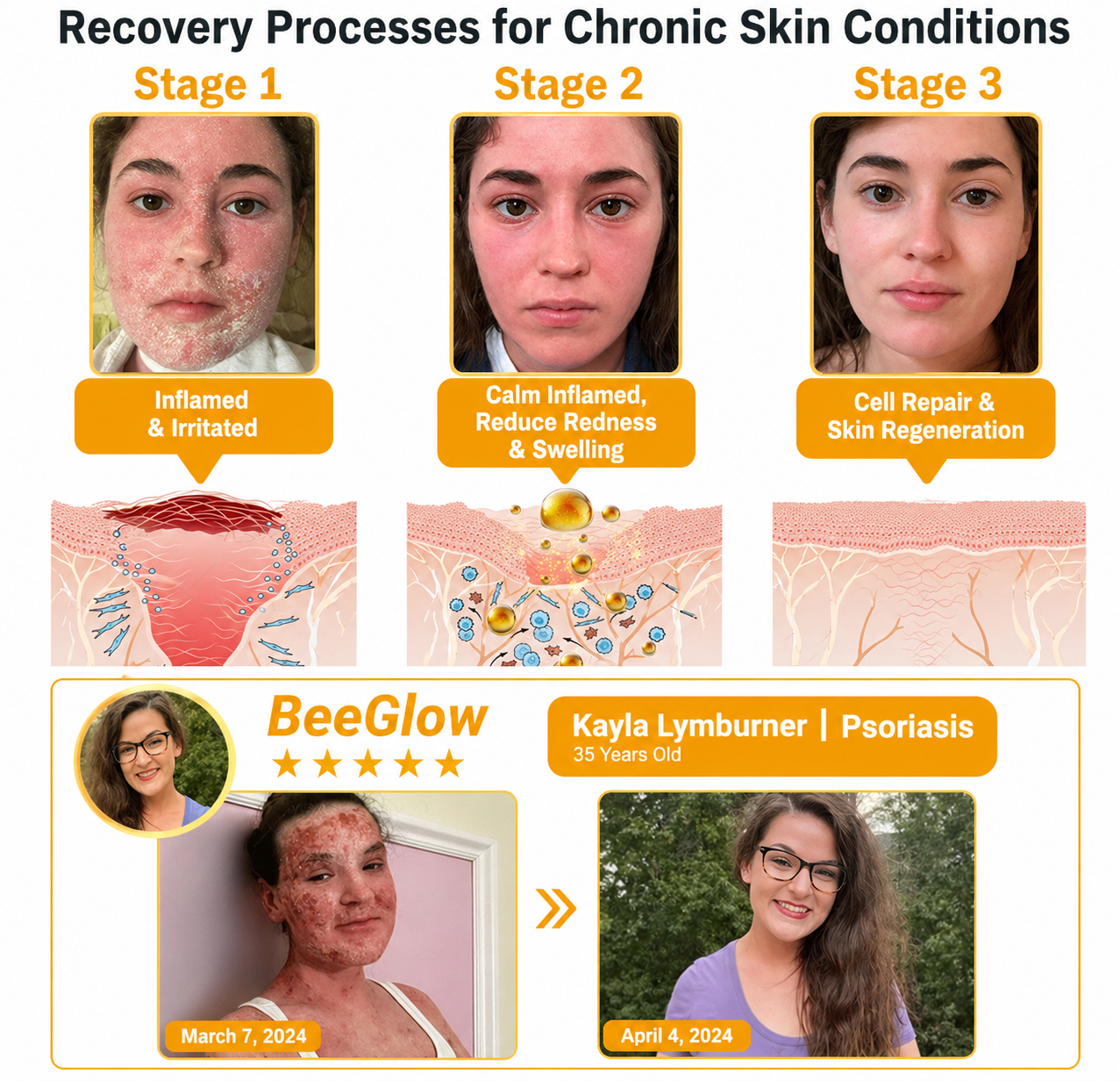 🔥 Summer Sale Up to 40% BeeGlow Skin Repair Cream thumbnail 2