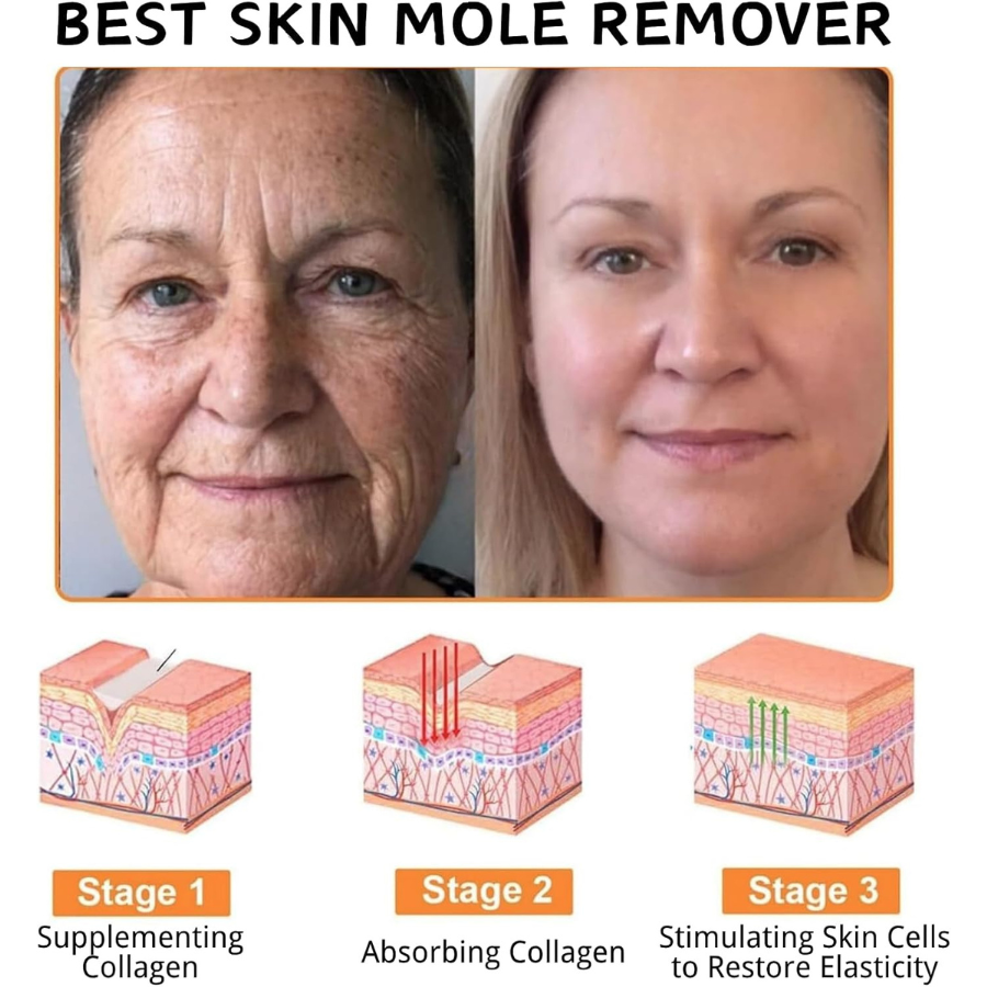 🔥 Summer Sale Up to 40% BeeGlow Skin Repair Cream thumbnail 3