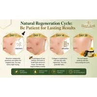 🔥 Summer Sale Up to 40% BeeGlow Skin Repair Cream thumbnail 10