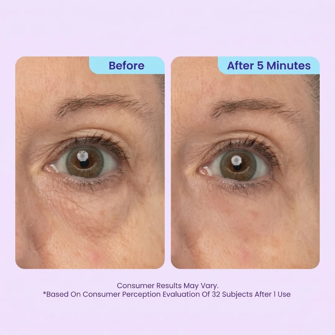 🔥SPECIAL LAUNCH PRICE🔥Instant Lift Eye Gel | For Puffiness & Bags, Wrinkles, Fine Lines and Dark Circles thumbnail 4