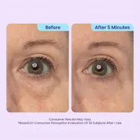 🔥SPECIAL LAUNCH PRICE🔥Instant Lift Eye Gel | For Puffiness & Bags, Wrinkles, Fine Lines and Dark Circles thumbnail 3