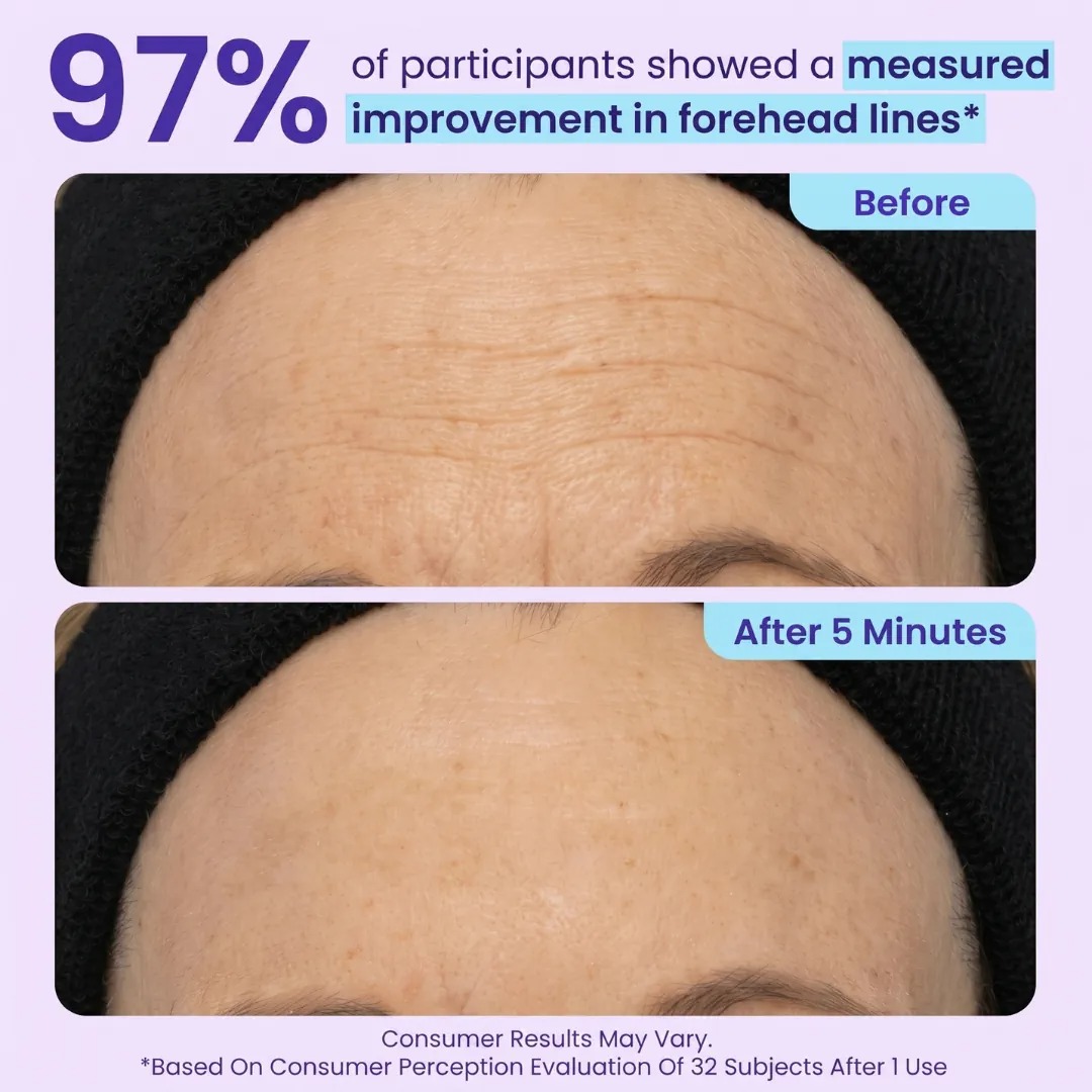 🔥SPECIAL LAUNCH PRICE🔥Instant Lift Eye Gel | For Puffiness & Bags, Wrinkles, Fine Lines and Dark Circles thumbnail 5