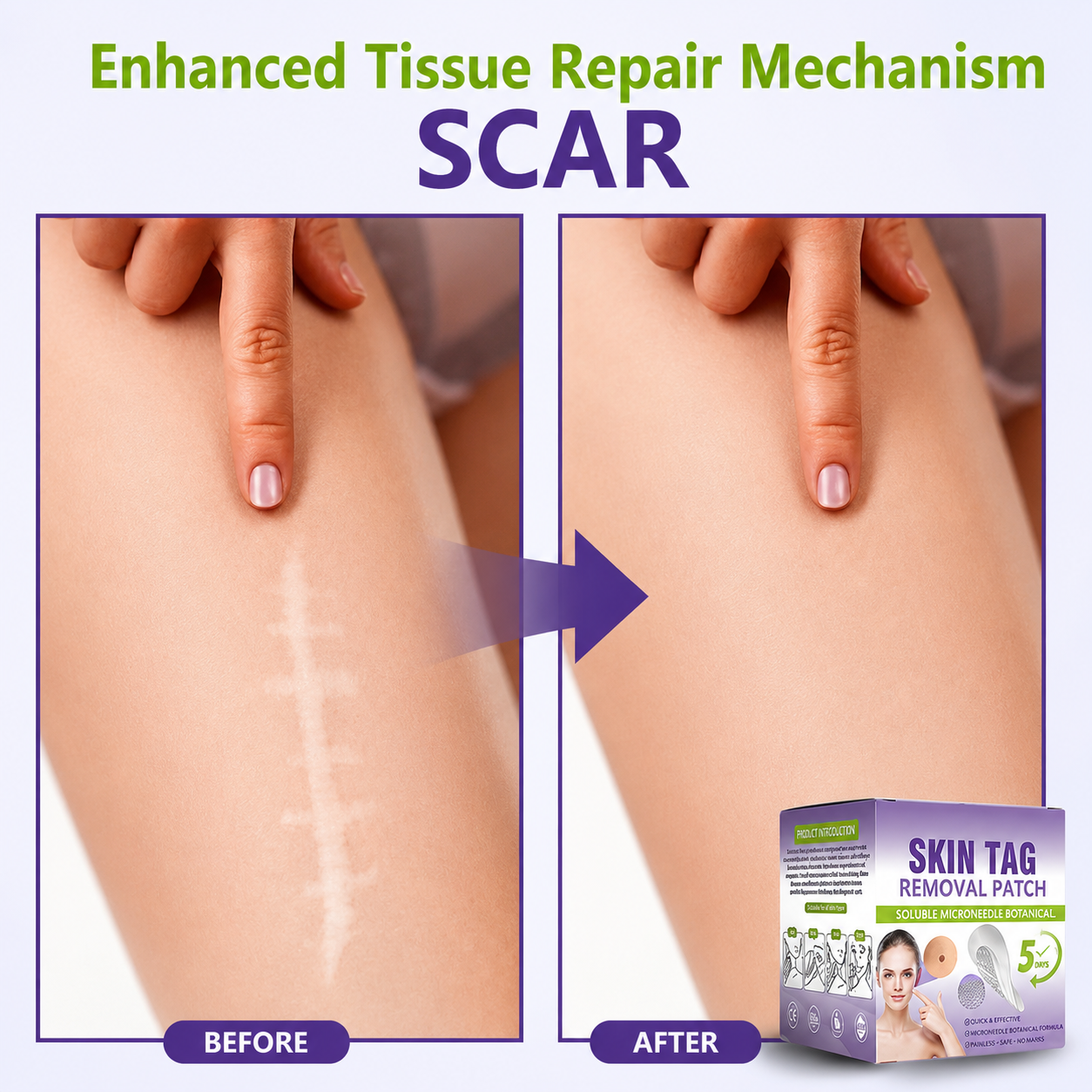 🔥 SALE OFF UP TO 60%🔥💥 Soluble Microneedle Botanical Skin Tag Removal Patch thumbnail 7