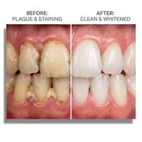🔥Summer Sale Upto 60% Oxygen Smile Whitening Mouthwash thumbnail 6