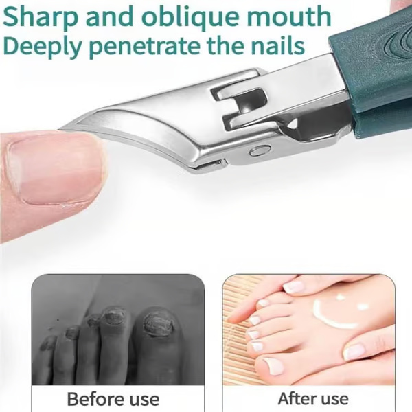 🔥 HOT DEAL Save Up To 50% - Premium 3-Piece Eagle Beak Nail Clipper Set🔥 - Image 1