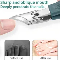 🔥 HOT DEAL Save Up To 50% - Premium 3-Piece Eagle Beak Nail Clipper Set🔥 thumbnail 1