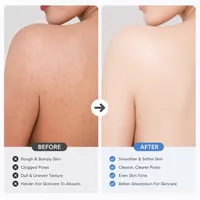 ✨ Softer Skin Starts In The Shower — 50% OFF Today thumbnail 3