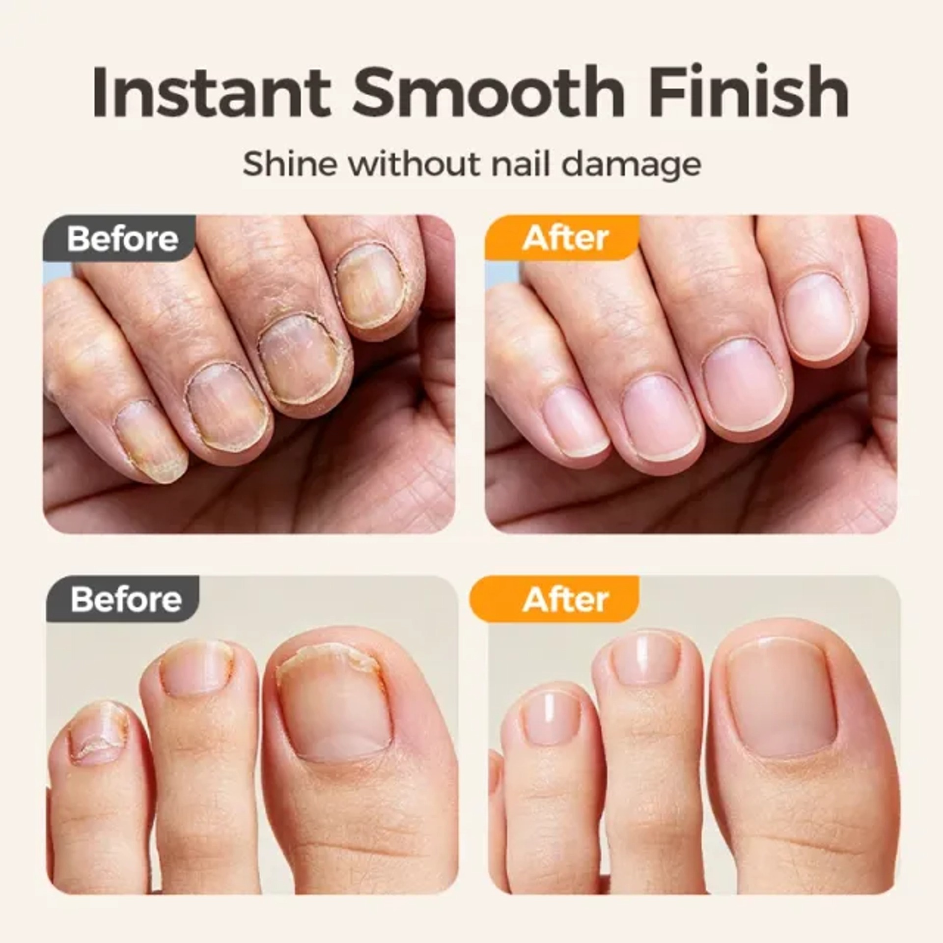 ⏳Time-Limited Special⏰2-in-1 Smart Electric Nail Trimmer & Polisher for All Ages 👨‍👩‍👧‍👦 – Blade-Free, Blood-Free & thumbnail 4
