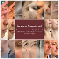 ✨Changing People's Skin Overnight 🛡️ Helps Improve Wrinkles, Scars & Blemishes thumbnail 5