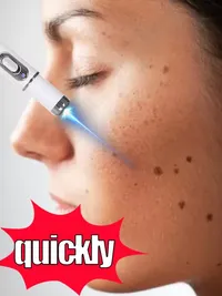 🔥𝗤𝗩𝗖™ Mother-Days SALE OFF UP TO 50%🔥🔥Laser pen blue light pen maintain a healthy body thumbnail 1